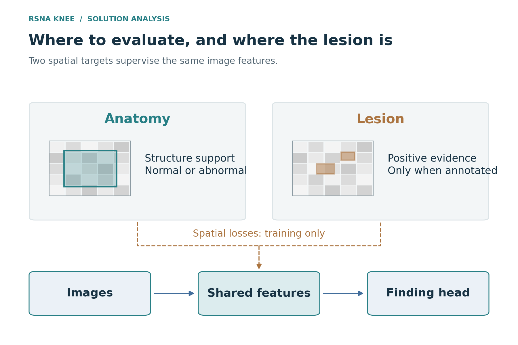 Anatomy and lesion supervision of shared image features